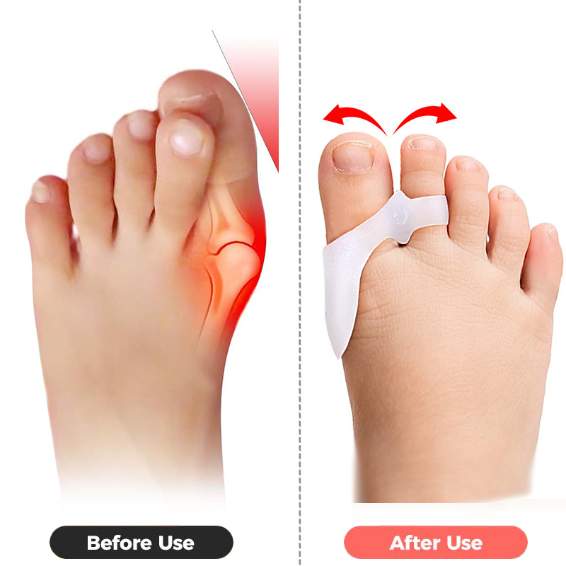 Pexmen 2/4Pcs Toe Spacers Prot - огляд і ціна Power Tools Kids